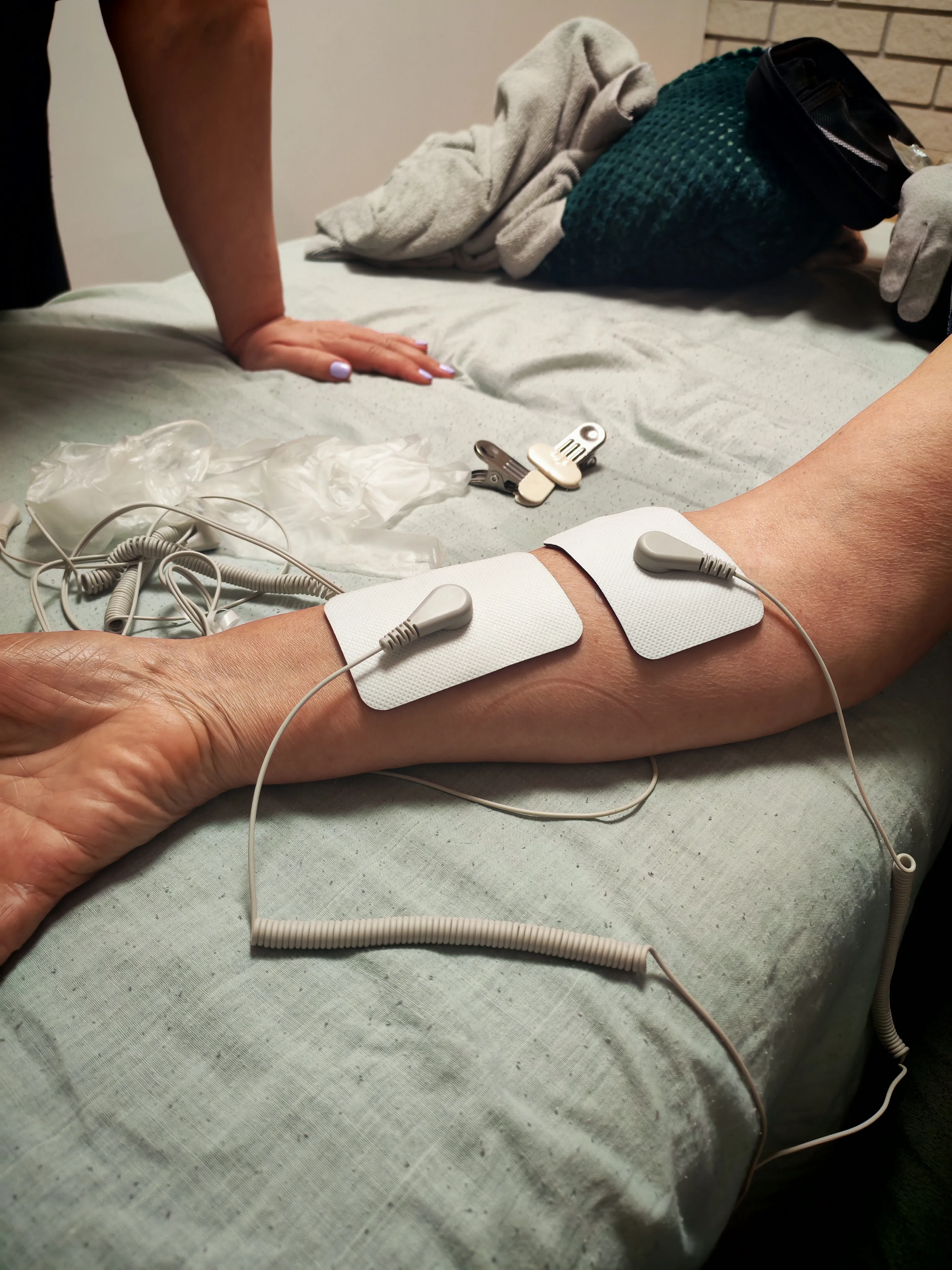 TENS elektróda felhelyezés a háton